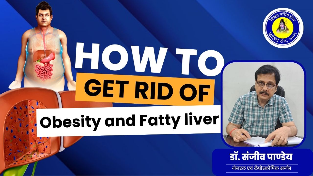 Obesity and Fatty Liver